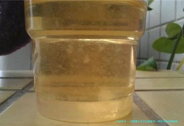 试管婴儿手术注意事项，附怀孕后护理指南