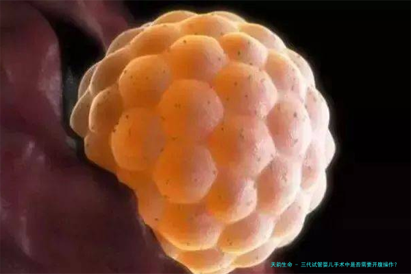 三代试管婴儿手术中是否需要开腹操作？