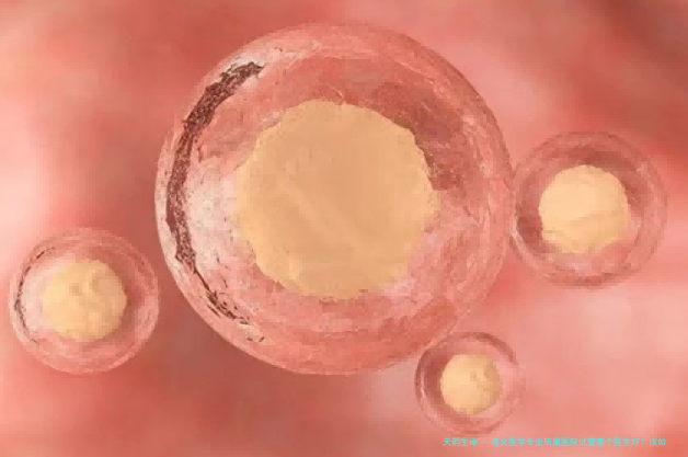 遵义医学专业所属医院试管哪个医生好？该如何减少花费