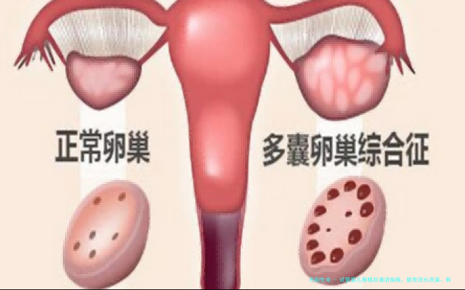 试管婴儿移植后清洁指南，能否洗头洗澡、有无危害一文释疑