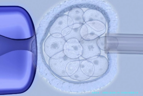 试管婴儿能选择xy吗？你怕是对试管婴儿有什么误解
