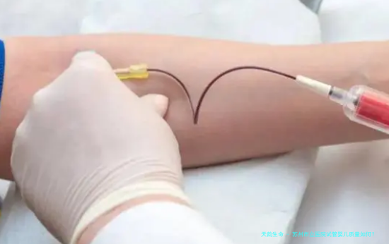 苏州市立医院试管婴儿质量如何？