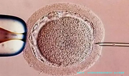 如何提高试管移植后的着床率？这4点很重要