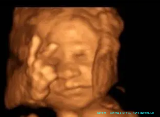 美国拉霍亚IVF中心：在这里做试管婴儿的原因有这些