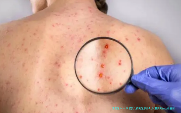 试管婴儿前要注意什么_试管婴儿抽血检查前要注意什么