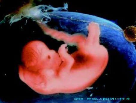 男性感染hiv后要孩子需要多少费用？附hiv试管费用详细攻略！