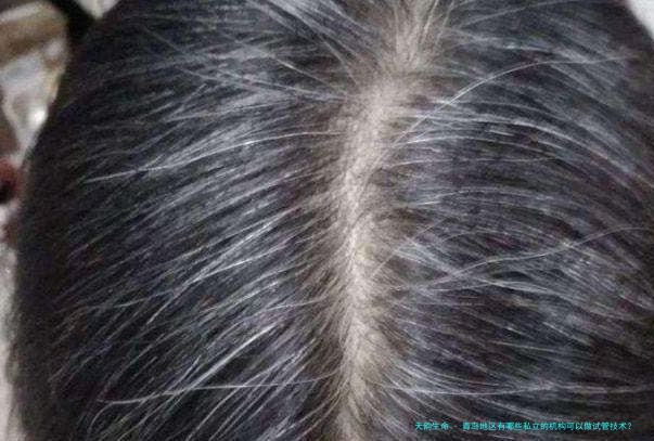 青岛地区有哪些私立的机构可以做试管技术？癌胚抗原(cea)高多少是癌症？