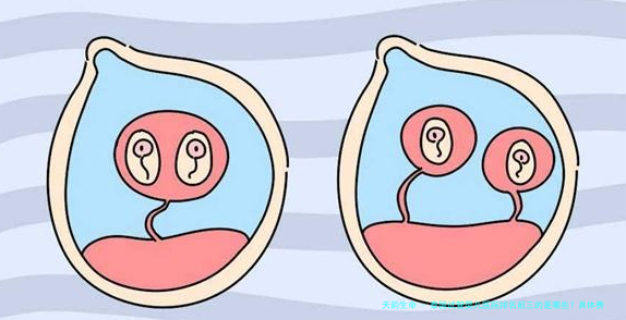 泰国试管婴儿医院排名前三的是哪些？具体费用明细一览