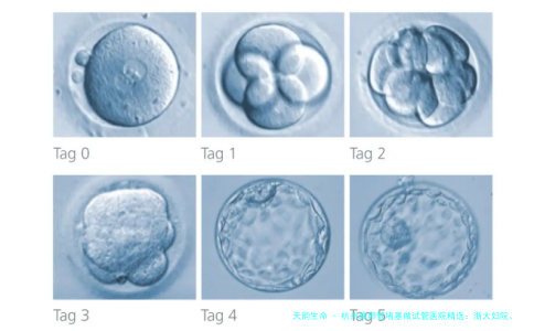 杭州输卵管堵塞做试管医院精选：浙大妇院、省妇保等五家医院技术与口碑解析，附2026年试管费用参考
