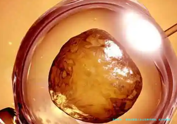 泰国试管婴儿全过程费用明细，成功率揭秘！