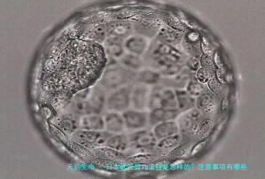 日本试管婴儿流程是怎样的？注意事项有哪些？