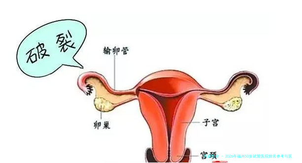 2026年福州50岁试管医院排名参考与医生解析，附详细费用明细表