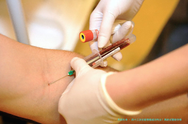 四十三岁还能移植成功吗女？高龄试管助孕移植成功率如何提高？