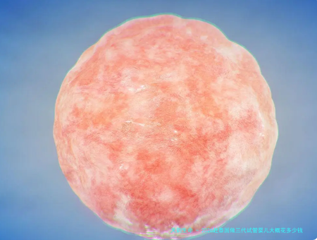 2026赴泰国做三代试管婴儿大概花多少钱？具体花费明细！