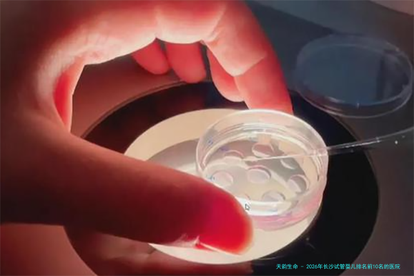 2026年长沙试管婴儿排名前10名的医院是哪些？附试管婴儿费用