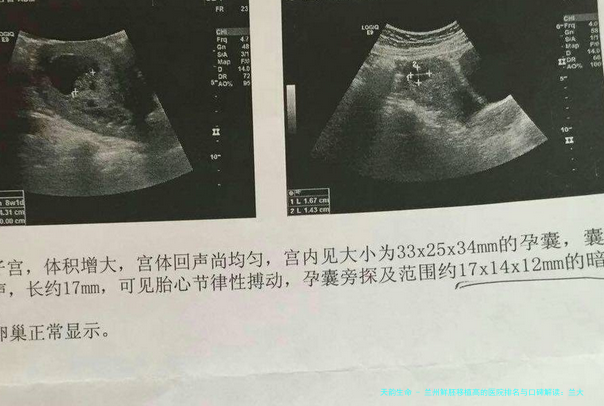 兰州鲜胚移植高的医院排名与口碑解读：兰大一院、甘肃省妇幼位列前茅